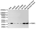 Western Blot
Positive WB detected in: Hela whole cell lysate(30µg), HepG2 whole cell lysate(30µg), HEK293 whole cell lysate(30µg), U-251MG whole cell lysate(30µg), SH-SY5Y whole cell lysate(30µg), Mouse brain tissue lysate(30µg), Rat brain tissue lysate(30µg)
All lanes: PEBP1 antibody at 1:1000
Secondary
Goat polyclonal to rabbit IgG at 1/40000 dilution
Predicted band size: 21 kDa
Observed band size: 21 kDa
Exposure time：1min