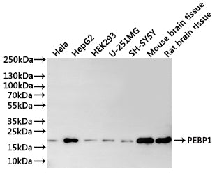 Western Blot
Positive WB detected in: Hela whole cell lysate(30µg), HepG2 whole cell lysate(30µg), HEK293 whole cell lysate(30µg), U-251MG whole cell lysate(30µg), SH-SY5Y whole cell lysate(30µg), Mouse brain tissue lysate(30µg), Rat brain tissue lysate(30µg)
All lanes: PEBP1 antibody at 1:1000
Secondary
Goat polyclonal to rabbit IgG at 1/40000 dilution
Predicted band size: 21 kDa
Observed band size: 21 kDa
Exposure time：1min