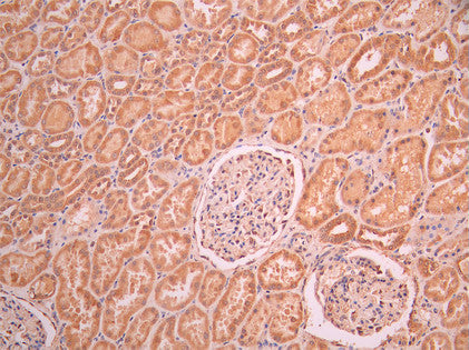 IHC image of CSB-RA903831A0HU diluted at 1:100 and staining in paraffin-embedded human kidney tissue performed on a Leica BondTM system. After dewaxing and hydration, antigen retrieval was mediated by high pressure in a citrate buffer (pH 6.0). Section was blocked with 10% normal goat serum 30min at RT. Then primary antibody (1% BSA) was incubated at 4°C overnight. The primary is detected by a Goat anti-rabbit polymer IgG labeled by HRP and visualized using 0.05% DAB.