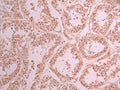 IHC image of CSB-RA904109A0HU diluted at 1:100 and staining in paraffin-embedded human testis tissue performed on a Leica BondTM system. After dewaxing and hydration, antigen retrieval was mediated by high pressure in a citrate buffer (pH 6.0) . Section was blocked with 10% normal goat serum 30min at RT. Then primary antibody (1% BSA) was incubated at 4°C overnight. The primary is detected by a Goat anti-rabbit polymer IgG labeled by HRP and visualized using 0.05% DAB.