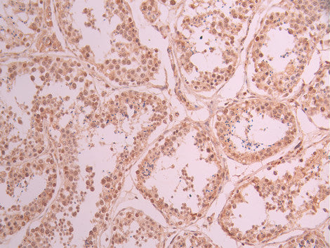 IHC image of CSB-RA904109A0HU diluted at 1:100 and staining in paraffin-embedded human testis tissue performed on a Leica BondTM system. After dewaxing and hydration, antigen retrieval was mediated by high pressure in a citrate buffer (pH 6.0) . Section was blocked with 10% normal goat serum 30min at RT. Then primary antibody (1% BSA) was incubated at 4°C overnight. The primary is detected by a Goat anti-rabbit polymer IgG labeled by HRP and visualized using 0.05% DAB.