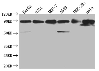 Western Blot
Positive WB detected in: HepG2 whole cell lysate, U251 whole cell lysate, MCF-7 whole cell lysate, A549 whole cell lysate, HEK293 whole cell lysate, Hela whole cell lysate
All lanes: HSP90AB1 antibody at 1:2000
Secondary
Goat polyclonal to rabbit IgG at 1/50000 dilution
Predicted band size: 84 kDa
Observed band size: 80-90 kDa
