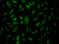 Immunofluorescence staining of Hela Cells with CSB-RA904931A0HU at 1:50, counter-stained with DAPI. The cells were fixed in 4% formaldehyde, permeated by 0.2% TritonX-100, and blocked in 10% normal Goat Serum. The cells were then incubated with the antibody overnight at 4℃. Nuclear DNA was labeled in blue with DAPI. The secondary antibody was FITC-conjugated AffiniPure Goat Anti-Rabbit IgG (H+L) .