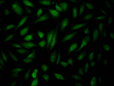 Immunofluorescence staining of Hela Cells with CSB-RA904931A0HU at 1:50, counter-stained with DAPI. The cells were fixed in 4% formaldehyde, permeated by 0.2% TritonX-100, and blocked in 10% normal Goat Serum. The cells were then incubated with the antibody overnight at 4℃. Nuclear DNA was labeled in blue with DAPI. The secondary antibody was FITC-conjugated AffiniPure Goat Anti-Rabbit IgG (H+L) .