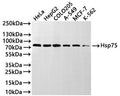 Western Blot
Positive WB detected in: HeLa whole cell lysate(30µg), HepG2 whole cell lysate(30µg), COLO-205 whole cell lysate(30µg), A-549 whole cell lysate(30µg), MCF-7 whole cell lysate(30µg), K-562 whole cell lysate(30µg)
All lanes: Hsp75 antibody at 1:1000
Secondary
Goat polyclonal to rabbit IgG at 1/40000 dilution
Predicted band size: 80 kDa
Observed band size: 80 kDa
Exposure time：2min