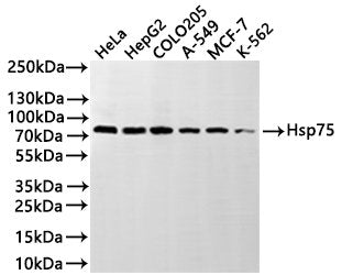 Western Blot
Positive WB detected in: HeLa whole cell lysate(30µg), HepG2 whole cell lysate(30µg), COLO-205 whole cell lysate(30µg), A-549 whole cell lysate(30µg), MCF-7 whole cell lysate(30µg), K-562 whole cell lysate(30µg)
All lanes: Hsp75 antibody at 1:1000
Secondary
Goat polyclonal to rabbit IgG at 1/40000 dilution
Predicted band size: 80 kDa
Observed band size: 80 kDa
Exposure time：2min