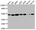Western Blot
Positive WB detected in: Hela whole cell lysate, 293 whole cell lysate, K562 whole cell lysate, 293T whole cell lysate, A549 whole cell lysate, Rat Brain whole cell lysate, Mouse Brain whole cell lysate
All lanes: NUDC antibody at 1:1000
Secondary
Goat polyclonal to rabbit IgG at 1/50000 dilution
Predicted band size: 39 kDa
Observed band size: 45 kDa
