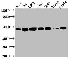 Western Blot
Positive WB detected in: Hela whole cell lysate, 293 whole cell lysate, K562 whole cell lysate, 293T whole cell lysate, A549 whole cell lysate, Rat Brain whole cell lysate, Mouse Brain whole cell lysate
All lanes: NUDC antibody at 1:1000
Secondary
Goat polyclonal to rabbit IgG at 1/50000 dilution
Predicted band size: 39 kDa
Observed band size: 45 kDa