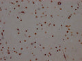 IHC image of CSB-RA906343A0HU diluted at 1:100 and staining in paraffin-embedded human brain tissue performed on a Leica BondTM system. After dewaxing and hydration, antigen retrieval was mediated by high pressure in a citrate buffer (pH 6.0) . Section was blocked with 10% normal goat serum 30min at RT. Then primary antibody (1% BSA) was incubated at 4℃ overnight. The primary is detected by a Goat anti-rabbit IgG polymer labeled by HRP and visualized using 0.05% DAB.