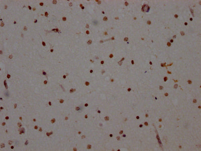 IHC image of CSB-RA906343A0HU diluted at 1:100 and staining in paraffin-embedded human brain tissue performed on a Leica BondTM system. After dewaxing and hydration, antigen retrieval was mediated by high pressure in a citrate buffer (pH 6.0) . Section was blocked with 10% normal goat serum 30min at RT. Then primary antibody (1% BSA) was incubated at 4℃ overnight. The primary is detected by a Goat anti-rabbit IgG polymer labeled by HRP and visualized using 0.05% DAB.