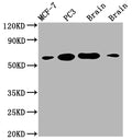 Western Blot
Positive WB detected in: MCF-7 whole cell lysate, PC3 whole cell lysate, Mouse brain tissue, Rat brain tissue
All lanes: LOXL2 antibody at 1:2000
Secondary
Goat polyclonal to rabbit IgG at 1/50000 dilution
Predicted band size: 87 kDa
Observed band size: 53 kDa