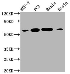 Western Blot
Positive WB detected in: MCF-7 whole cell lysate, PC3 whole cell lysate, Mouse brain tissue, Rat brain tissue
All lanes: LOXL2 antibody at 1:2000
Secondary
Goat polyclonal to rabbit IgG at 1/50000 dilution
Predicted band size: 87 kDa
Observed band size: 53 kDa