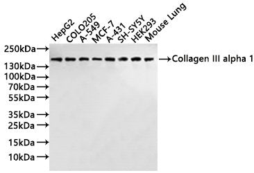 Western Blot
Positive WB detected in: HepG2 whole cell lysate(30µg), COLO-205 whole cell lysate(30µg), A-549 whole cell lysate(30µg), MCF-7 whole cell lysate(30µg), A-431 whole cell lysate(30µg), SH-SY5Y whole cell lysate(30µg), HEK293 whole cell lysate(30µg), Mouse lung tissue lysate(30µg)
All lanes: Collagen III alpha 1 antibody at 1:1000
Secondary
Goat polyclonal to rabbit IgG at 1/40000 dilution
Predicted band size: 139 kDa
Observed band size: 150 kDa
Exposure time：1min