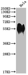 Western Blot
Positive WB detected in: Hela whole cell lysate
All lanes: CD46 antibody at 1:1000
Secondary
Goat polyclonal to rabbit IgG at 1/50000 dilution
Predicted band size: 44, 45, 43, 41, 42, 40, 37 kDa
Observed band size: 56 kDa