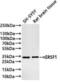 Western Blot
Positive WB detected in: SH-SY5Y whole cell lysate(30µg) , Rat brain tissue lysate(30µg) 
All lanes: SRSF1 antibody at 1:1000
Secondary
Goat polyclonal to rabbit IgG at 1/40000 dilution
Predicted band size: 28 kDa
Observed band size: 33 kDa
Exposure time：20s