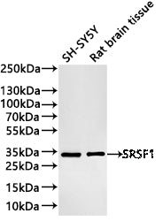 Western Blot
Positive WB detected in: SH-SY5Y whole cell lysate(30µg) , Rat brain tissue lysate(30µg) 
All lanes: SRSF1 antibody at 1:1000
Secondary
Goat polyclonal to rabbit IgG at 1/40000 dilution
Predicted band size: 28 kDa
Observed band size: 33 kDa
Exposure time：20s