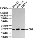 Western Blot
Positive WB detected in: HepG2 whole cell lysate(30µg) , COLO205 whole cell lysate(30µg) , MCF-7 whole cell lysate(30µg) 
All lanes: CD2 antibody at 1:1000
Secondary
Goat polyclonal to rabbit IgG at 1/50000 dilution
Predicted band size: 39 kDa
Observed band size: 24 kDa
Exposure time: 3min
