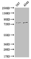 Western Blot
Positive WB detected in: U87 whole cell lysate, A549 whole cell lysate
All lanes: SLC25A12 antibody at 1:1000
Secondary
Goat polyclonal to rabbit IgG at 1/50000 dilution
Predicted band size: 75, 63 kDa
Observed band size: 72-80 kDa