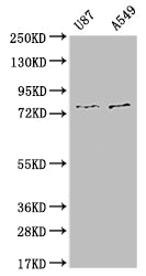 Western Blot
Positive WB detected in: U87 whole cell lysate, A549 whole cell lysate
All lanes: SLC25A12 antibody at 1:1000
Secondary
Goat polyclonal to rabbit IgG at 1/50000 dilution
Predicted band size: 75, 63 kDa
Observed band size: 72-80 kDa
