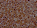 IHC image of CSB-RA912740A0HU diluted at 1:100 and staining in paraffin-embedded human liver tissue performed on a Leica BondTM system. After dewaxing and hydration, antigen retrieval was mediated by high pressure in a citrate buffer (pH 6.0) . Section was blocked with 10% normal goat serum 30min at RT. Then primary antibody (1% BSA) was incubated at 4℃ overnight. The primary is detected by a Goat anti-rabbit IgG polymer labeled by HRP and visualized using 0.05% DAB.