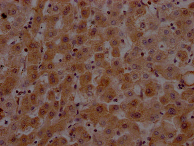 IHC image of CSB-RA912740A0HU diluted at 1:100 and staining in paraffin-embedded human liver tissue performed on a Leica BondTM system. After dewaxing and hydration, antigen retrieval was mediated by high pressure in a citrate buffer (pH 6.0) . Section was blocked with 10% normal goat serum 30min at RT. Then primary antibody (1% BSA) was incubated at 4℃ overnight. The primary is detected by a Goat anti-rabbit IgG polymer labeled by HRP and visualized using 0.05% DAB.