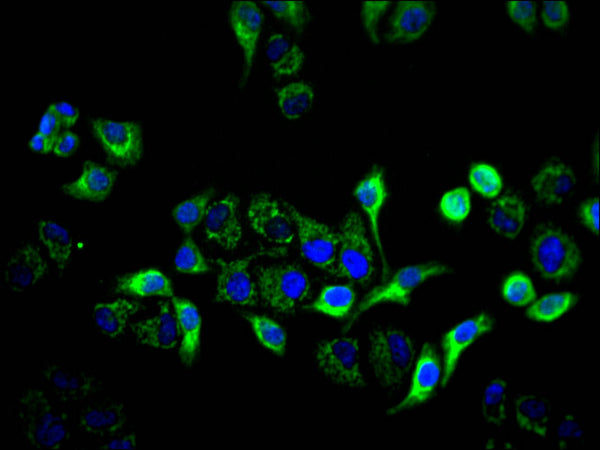 Immunofluorescence staining of Hela cell with CSB-RA914278A0HU at 1:50, counter-stained with DAPI. The cells were fixed in 4% formaldehyde, permeabilized using 0.2% Triton X-100 and blocked in 10% normal Goat Serum. The cells were then incubated with the antibody overnight at 4°C. The secondary antibody was Alexa Fluor 488-congugated AffiniPure Goat Anti-Rabbit IgG(H+L) .