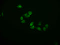 Immunofluorescence staining of Hela cell with CSB-RA914307A0HU at 1:50, counter-stained with DAPI. The cells were fixed in 4% formaldehyde and blocked in 10% normal Goat Serum. The cells were then incubated with the antibody overnight at 4°C. The secondary antibody was Alexa Fluor 591-congugated AffiniPure Goat Anti-Rabbit IgG(H+L) .