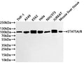 Western Blot
Positive WB detected in: THP-1 whole cell lysate(20µg) , A549 whole cell lysate(20µg) ,K-562 whole cell lysate(20µg) ,Hela whole cell lysate(20µg) ,NIH/3T3 whole cell lysate(20µg) ,JURKAT whole cell lysate(20µg) , Mouse liver tissue lysate(20µg) 
All lanes: STAT5A/B antibody at 1:1000
Secondary
Goat polyclonal to rabbit IgG at 1/40000 dilution
Predicted band size: 90 kDa
Observed band size: 102 kDa
Exposure time：40s
