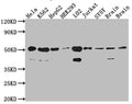 Western Blot
Positive WB detected in: Hela whole cell lysate, K562 whole cell lysate, HepG2 whole cell lysate, HEK293 whole cell lysate, L02 whole cell lysate, Jurkat whole cell lysate, SH-SY5Y whole cell lysate, Mouse Brain whole cell lysate, Rat Brain cell lysate
All lanes: RbAp48 antibody at 1:1000
Secondary
Goat polyclonal to rabbit IgG at 1/50000 dilution
Predicted band size: 48, 48, 47, 44 kDa
Observed band size: 53, 40 kDa