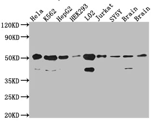 Western Blot
Positive WB detected in: Hela whole cell lysate, K562 whole cell lysate, HepG2 whole cell lysate, HEK293 whole cell lysate, L02 whole cell lysate, Jurkat whole cell lysate, SH-SY5Y whole cell lysate, Mouse Brain whole cell lysate, Rat Brain cell lysate
All lanes: RbAp48 antibody at 1:1000
Secondary
Goat polyclonal to rabbit IgG at 1/50000 dilution
Predicted band size: 48, 48, 47, 44 kDa
Observed band size: 53, 40 kDa