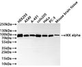 Western Blot
Positive WB detected in: HEK293 whole cell lysate(30µg) , A549 whole cell lysate(30µg) , A-431 whole cell lysate(30µg) , COLO205 whole cell lysate(30µg) , HeLa whole cell lysate(30µg) , PC-3 whole cell lysate(30µg) , Mouse brain tissue lysate(30µg) 
All lanes: IKK alpha antibody at 1:1000
Secondary
Goat polyclonal to rabbit IgG at 1/50000 dilution
Predicted band size: 85 kDa
Observed band size: 85 kDa
Exposure time: 2min