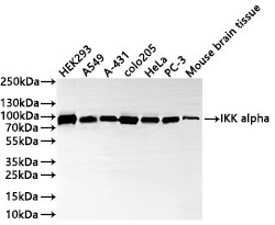 Western Blot
Positive WB detected in: HEK293 whole cell lysate(30µg) , A549 whole cell lysate(30µg) , A-431 whole cell lysate(30µg) , COLO205 whole cell lysate(30µg) , HeLa whole cell lysate(30µg) , PC-3 whole cell lysate(30µg) , Mouse brain tissue lysate(30µg) 
All lanes: IKK alpha antibody at 1:1000
Secondary
Goat polyclonal to rabbit IgG at 1/50000 dilution
Predicted band size: 85 kDa
Observed band size: 85 kDa
Exposure time: 2min