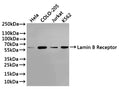Western Blot
Positive WB detected in: Hela whole cell lysate(30µg), COLO-205 whole cell lysate(30µg), Jurkat whole cell lysate(30µg), K562 whole cell lysate(30µg)
All lanes: LaminB Receptor antibody at 1:1000
Secondary
Goat polyclonal to rabbit IgG at 1/40000 dilution
Predicted band size: 71 kDa
Observed band size: 58 kDa
Exposure time：3min