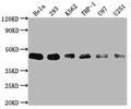 Western Blot
Positive WB detected in: Hela whole cell lysate, 293 whole cell lysate, K562 whole cell lysate, THP-1 whole cell lysate, U87 whole cell lysate, U251 whole cell lysate
All lanes: BMI1 antibody at 1:2000
Secondary
Goat polyclonal to rabbit IgG at 1/50000 dilution
Predicted band size: 37 kDa
Observed band size: 45 kDa