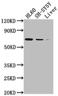 Western Blot
Positive WB detected in: HL60 whole cell lysate, SH-SY5Y whole cell lysate, Mouse liver tissue
All lanes: PTGS1 antibody at 1:2000
Secondary
Goat polyclonal to rabbit IgG at 1/50000 dilution
Predicted band size: 69, 65, 62, 57, 72, 73 kDa
Observed band size: 72 kDa