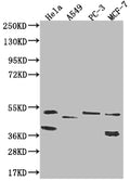 Western Blot
Positive WB detected in: Hela whole cell lysate, A549 whole cell lysate, PC-3 whole cell lysate, MCF-7 whole cell lysate
All lanes: PLEKHA1 antibody at 1:1000
Secondary
Goat polyclonal to rabbit IgG at 1/50000 dilution
Predicted band size: 46, 39 kDa
Observed band size: 36-55 kDa