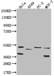 Western Blot
Positive WB detected in: Hela whole cell lysate, A549 whole cell lysate, PC-3 whole cell lysate, MCF-7 whole cell lysate
All lanes: PLEKHA1 antibody at 1:1000
Secondary
Goat polyclonal to rabbit IgG at 1/50000 dilution
Predicted band size: 46, 39 kDa
Observed band size: 36-55 kDa