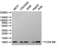 Western Blot
Positive WB detected in: MCF7 whole cell lysate(30µg), COLO205 whole cell lysate(30µg), A549 whole cell lysate(30µg), HepG2 whole cell lysate(30µg), Hela whole cell lysate(30µg)
All lanes:COX 6B1 antibody at 1:1000
Secondary
Goat polyclonal to rabbit IgG at 1/40000 dilution
Predicted band size: 10 kDa
Observed band size:10 kDa
Exposure time：180min