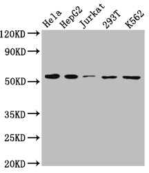 Western Blot
Positive WB detected in: Hela whole cell lysate, HepG2 whole cell lysate, Jurkat whole cell lysate, 293T whole cell lysate, K562 whole cell lysate
All lanes: MCT1 antibody at 1:1000
Secondary
Goat polyclonal to rabbit IgG at 1/50000 dilution
Predicted band size: 54, 47 kDa
Observed band size: 54 kDa