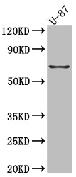 Western Blot
Positive WB detected in: U-87 whole cell lysate
All lanes: COX2 Antibody at 1:1000
Secondary
Goat polyclonal to rabbit IgG at 1/50000 dilution
Predicted band size: 69 kDa
Observed band size: 69 kDa