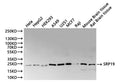 Western Blot
Positive WB detected in: Hela whole cell lysate(30µg), HepG2 whole cell lysate(30µg), HEK293 whole cell lysate(30µg), A549 whole cell lysate(30µg), U-251MG whole cell lysate(30µg), MCF-7 whole cell lysate(30µg), Raji whole cell lysate(30µg), Mouse brain tissue lysate(30µg), Rat brain tissue lysate(30µg)
All lanes:SRP19 antibody at 1:1000
Secondary
Goat polyclonal to rabbit IgG at 1/40000 dilution
Predicted band size: 16 kDa
Observed band size: 20 kDa
Exposure time：2min