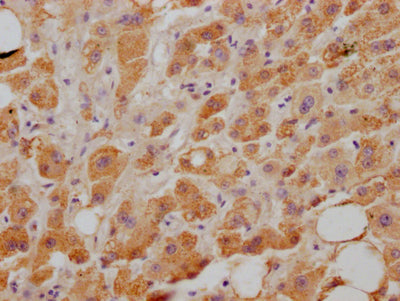 IHC image of CSB-RA921474A0HU diluted at 1:100 and staining in paraffin-embedded human liver tissue performed on a Leica BondTM system. After dewaxing and hydration, antigen retrieval was mediated by high pressure in a citrate buffer (pH 6.0) . Section was blocked with 10% normal goat serum 30min at RT. Then primary antibody (1% BSA) was incubated at 4℃ overnight. The primary is detected by a Goat anti-rabbit IgG polymer labeled by HRP and visualized using 0.05% DAB.