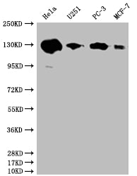 Western Blot
Positive WB detected in: Hela whole cell lysate, U251 whole cell lysate, PC3 whole cell lysate, MCF-7 whole cell lysate
All lanes: PKN2 antibody at 1:2000
Secondary
Goat polyclonal to rabbit IgG at 1/50000 dilution
Predicted band size: 113, 117, 112 kDa
Observed band size: 130 kDa