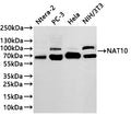 Western Blot
Positive WB detected in: Ntera-2 whole cell lysate(30µg) ,PC-3 whole cell lysate(30µg) , Hela whole cell lysate(30µg) ,NIH/3T3 whole cell lysate(30µg) 
All lanes: RANGAP1 antibody at 1:1000
Secondary
Goat polyclonal to rabbit IgG at 1/40000 dilution
Predicted band size: 64 kDa
Observed band size: 64,90 kDa
Exposure time：2min