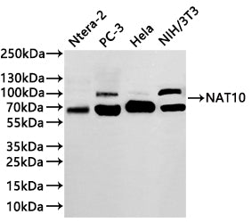 Western Blot
Positive WB detected in: Ntera-2 whole cell lysate(30µg) ,PC-3 whole cell lysate(30µg) , Hela whole cell lysate(30µg) ,NIH/3T3 whole cell lysate(30µg) 
All lanes: RANGAP1 antibody at 1:1000
Secondary
Goat polyclonal to rabbit IgG at 1/40000 dilution
Predicted band size: 64 kDa
Observed band size: 64,90 kDa
Exposure time：2min