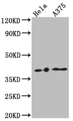 Western Blot
Positive WB detected in: Hela whole cell lysate, A375 whole cell lysate
All lanes: EDG2 antibody at 1:1000
Secondary
Goat polyclonal to rabbit IgG at 1/50000 dilution
Predicted band size: 42, 42 kDa
Observed band size: 42 kDa