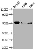 Western Blot
Positive WB detected in: HepG2 whole cell lysate, A549 whole cell lysate, K562 whole cell lysate
All lanes: Factor IX antibody at 1:2000
Secondary
Goat polyclonal to rabbit IgG at 1/50000 dilution
Predicted band size: 52 kDa
Observed band size: 52 kDa