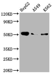 Western Blot
Positive WB detected in: HepG2 whole cell lysate, A549 whole cell lysate, K562 whole cell lysate
All lanes: Factor IX antibody at 1:2000
Secondary
Goat polyclonal to rabbit IgG at 1/50000 dilution
Predicted band size: 52 kDa
Observed band size: 52 kDa