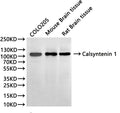 Western Blot
Positive WB detected in: COLO205 whole cell lysate(30µg), Mouse brain tissue lysate(30µg), Rat brain tissue lysate(30µg)
All lanes:Calsyntenin 1 antibody at 1:1000
Secondary
Goat polyclonal to rabbit IgG at 1/40000 dilution
Predicted band size: 110 kDa
Observed band size: 110 kDa
Exposure time：1min