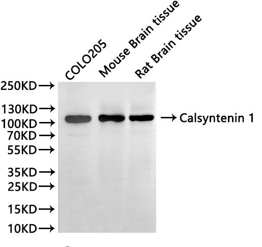 Western Blot
Positive WB detected in: COLO205 whole cell lysate(30µg), Mouse brain tissue lysate(30µg), Rat brain tissue lysate(30µg)
All lanes:Calsyntenin 1 antibody at 1:1000
Secondary
Goat polyclonal to rabbit IgG at 1/40000 dilution
Predicted band size: 110 kDa
Observed band size: 110 kDa
Exposure time：1min